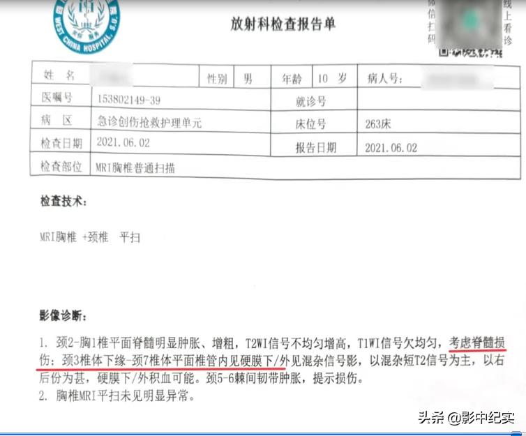 十岁的男孩开卡丁车追尾,10岁男孩玩卡丁车拦腰截瘫