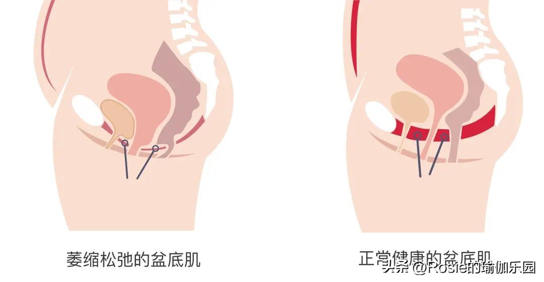 章泽天产后修复,章泽天产后美照