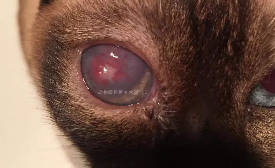 角膜溃疡怎么手术,角膜溃疡的治疗一般多久能治好