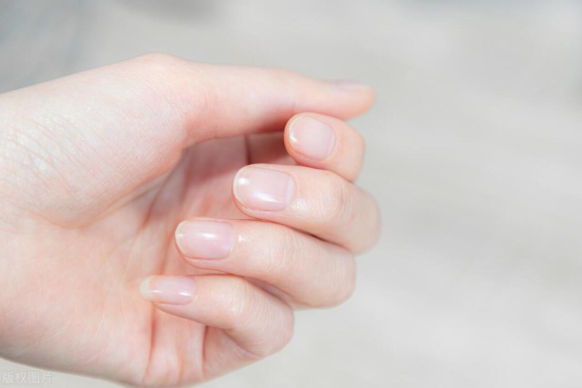 身体出现这些症状缺什么你知道吗,缺少蛋白质的人吃什么补得快