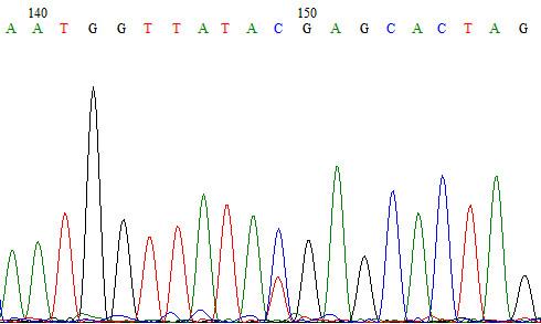 黄疸遗传代谢性疾病,遗传代谢性黄疸怎么治疗