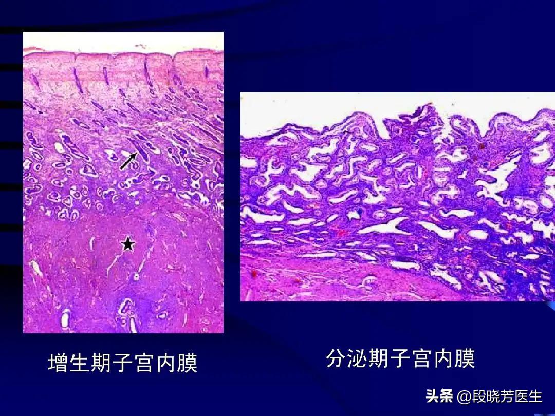 高龄促排容易流产吗,多次促排怀不上