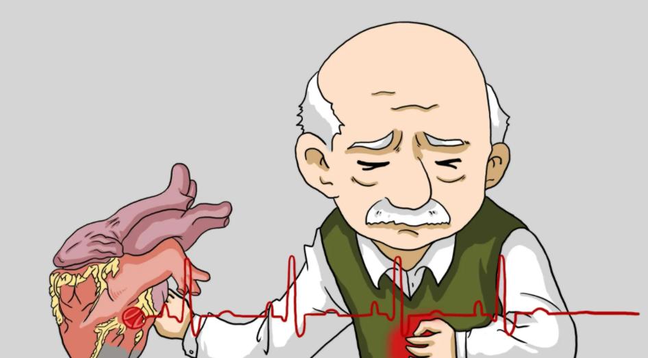 做完冠脉造影，病人就活不久了？冠脉造影检查对人体有什么危害？