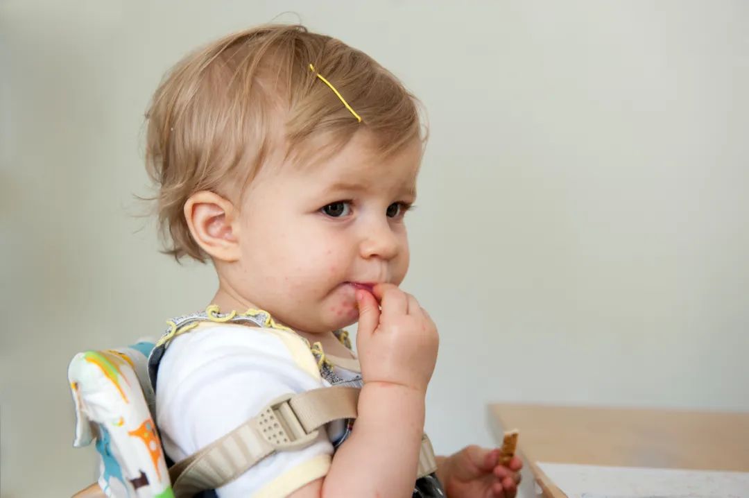 北京疾控手足口病进入高发期,中国疾控中心手足口病健康提示