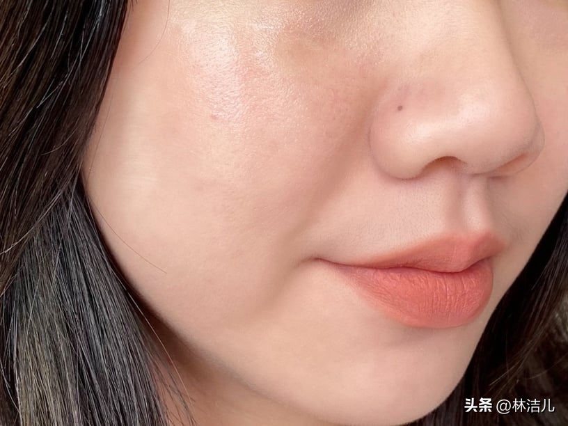 小棕瓶和小黑瓶祛痘,小棕瓶维稳抗老