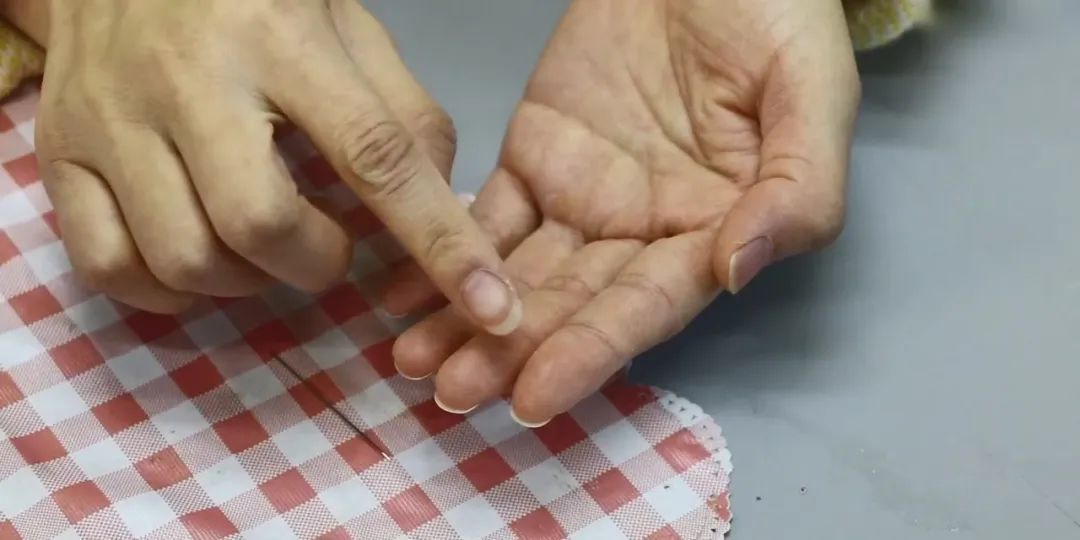 手指扎刺怎么取小妙招,挑手指扎刺小窍门