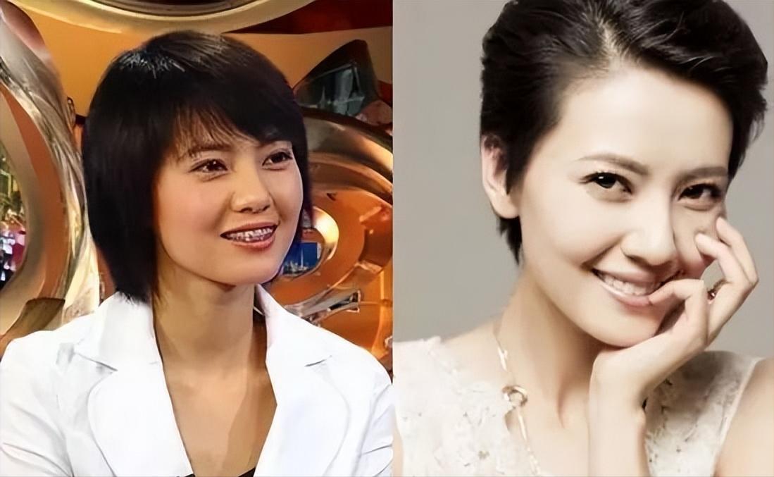 明星的牙都很齐吗,明星的牙齿都很好看