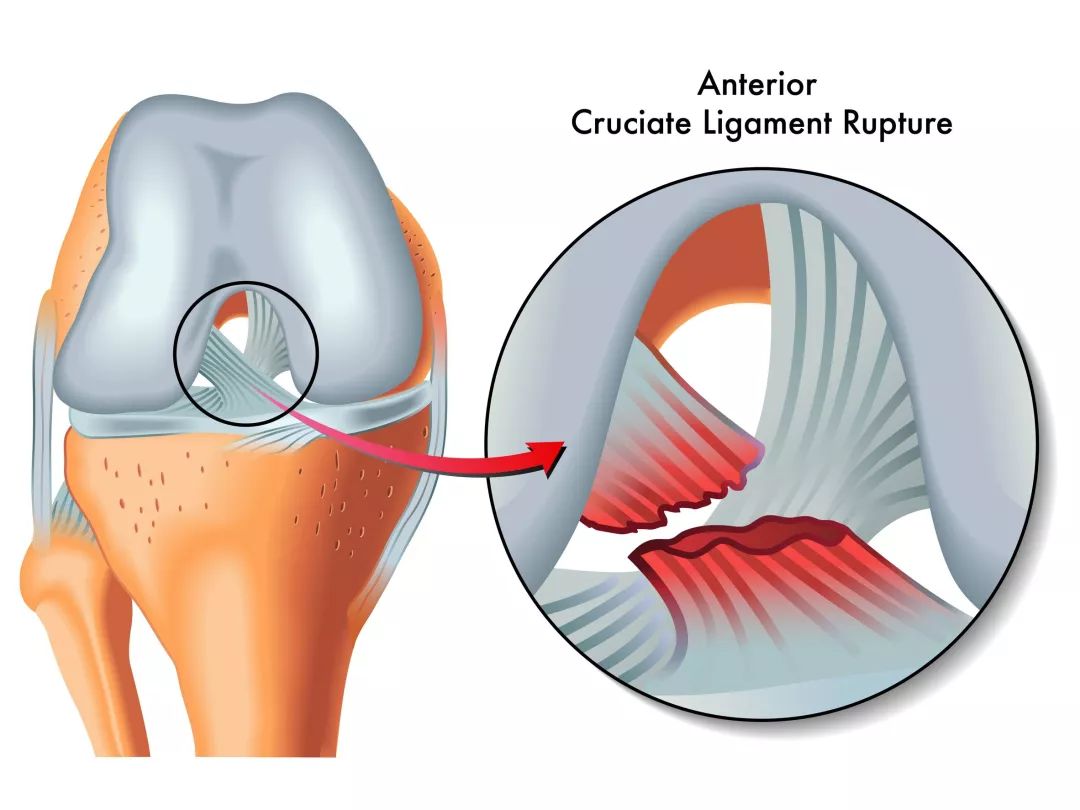法国小将因伤无缘世界杯,法国6名大将因伤无缘世界杯