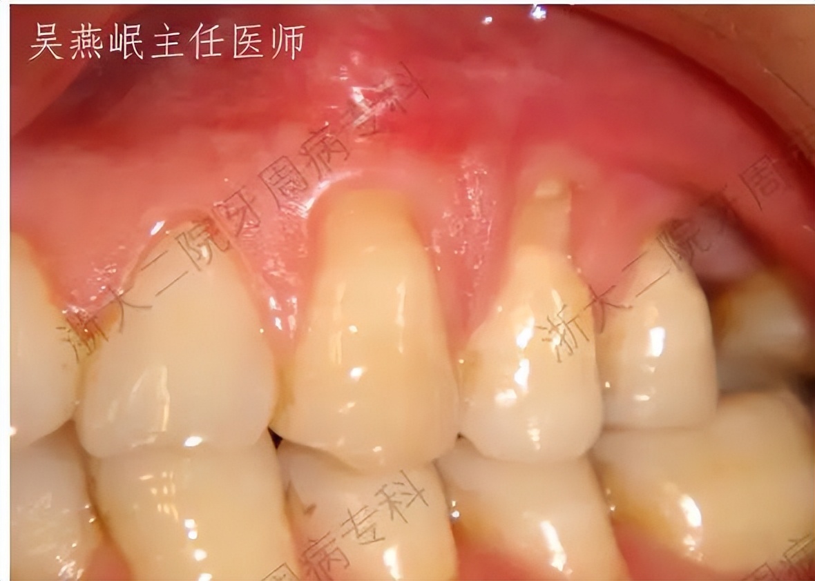 怎么拯救脱发小仙女,如何拯救牙齿上的黑洞