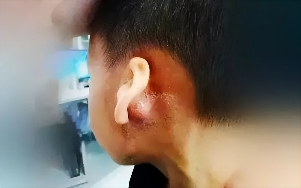 6个月宝宝听力不敏感长大会好吗,宝宝听力重度有没有可能听力正常