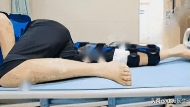 后交叉韧带重建术后康复计划,后交叉韧带重建术后康复角度指导