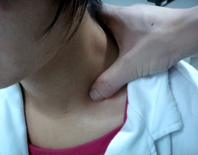 颈性眩晕经方治疗案例,颈性眩晕的中医辨证治疗