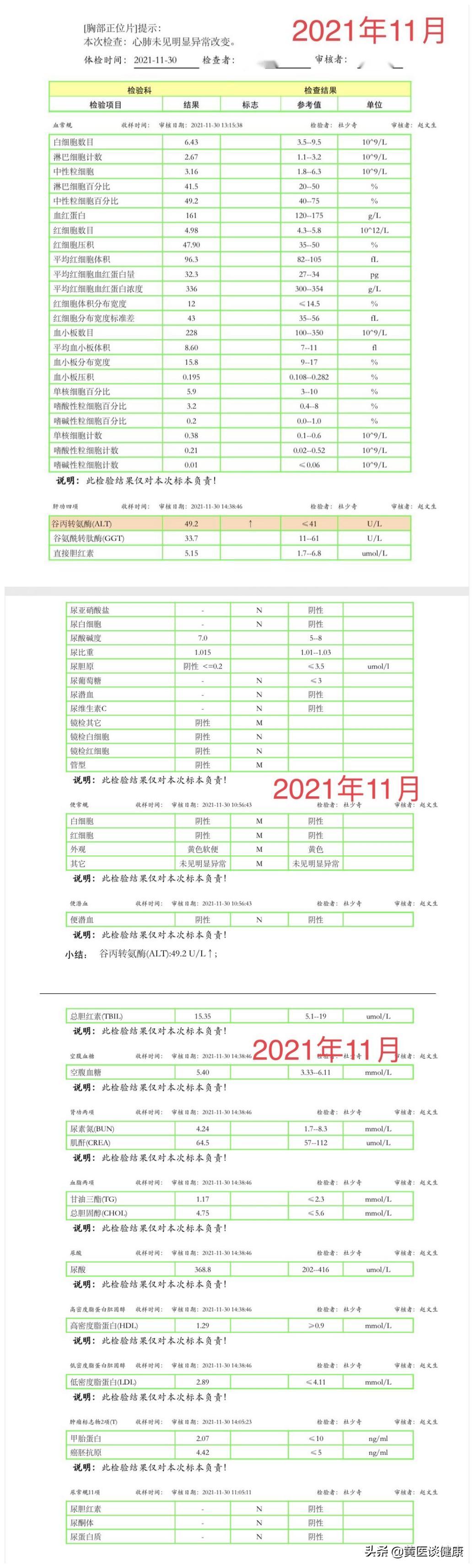 乙肝大三阳10多年,乙肝表面抗体升高至28说明什么