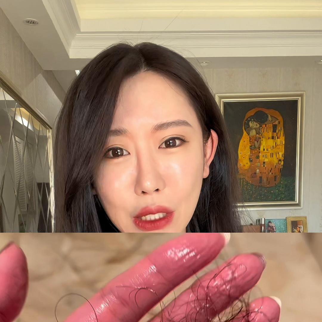 米诺地尔生发液2%亲测,米诺地尔生发液适合细软塌发质吗