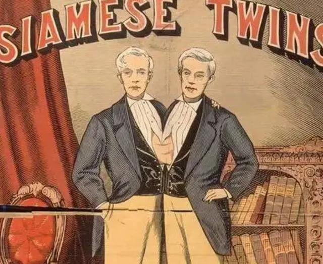 泰国连体人邦克,连体人结婚生子