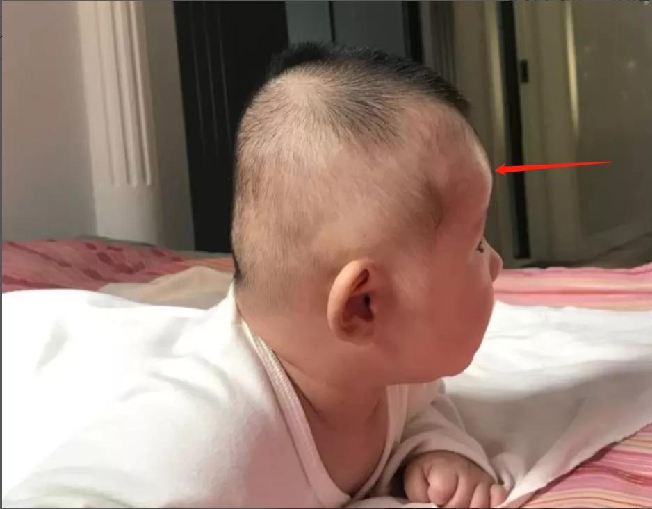 扁头有多毁颜值,扁头对颜值影响有多大