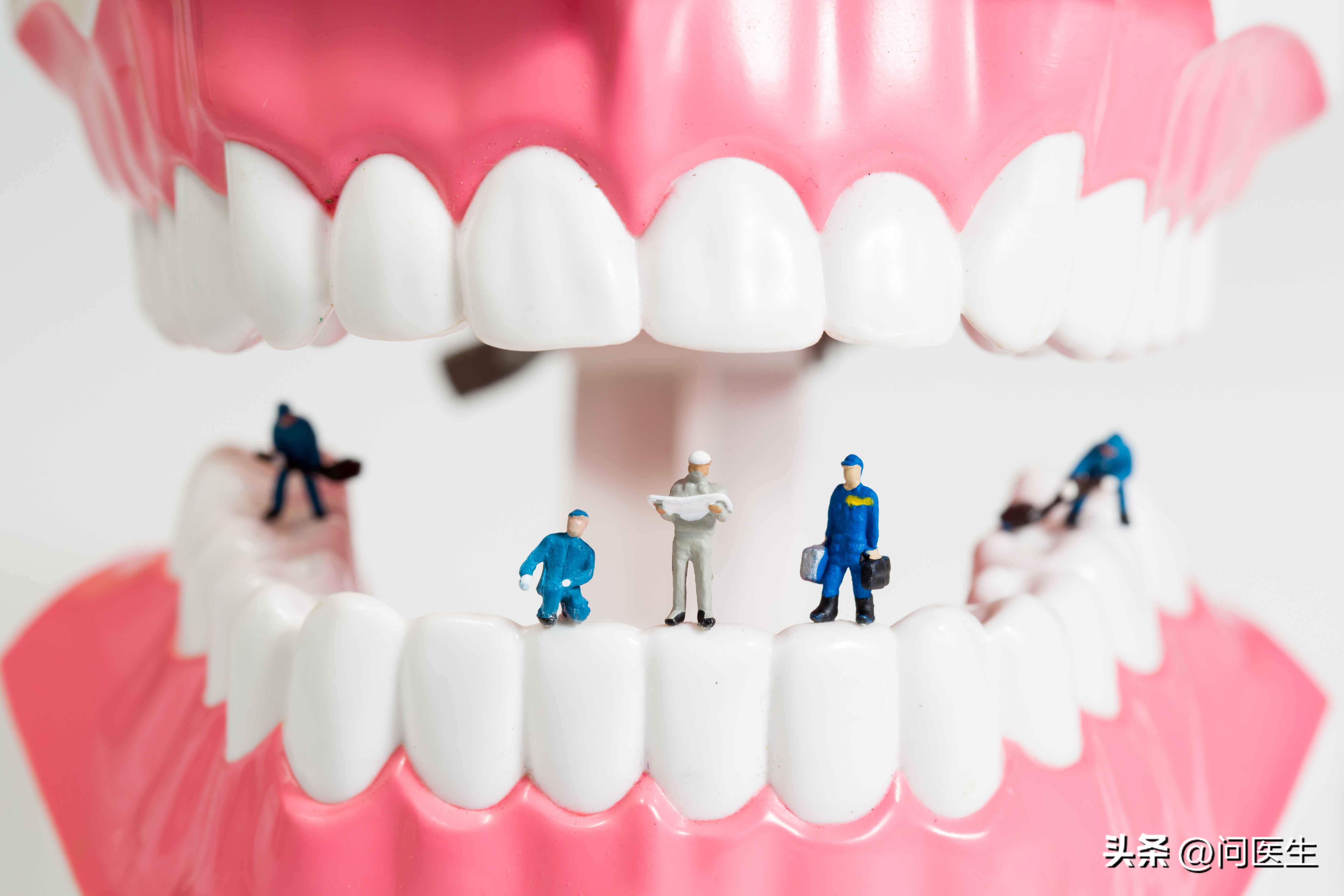 女子因洁牙感染梅毒？常见这些行为会不会感染上梅毒？