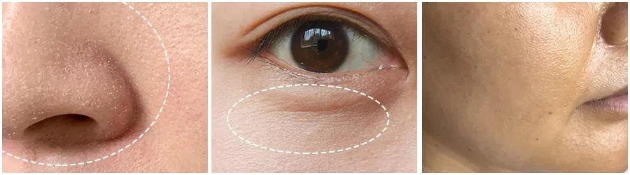 最安全又有用的美容项目,在这次美容项目后我学到了什么