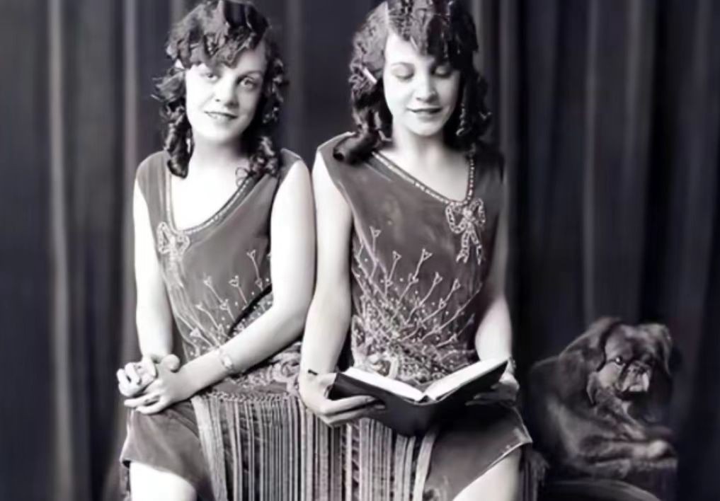 英国连体姐妹因流感去世,英国连体姐妹去世