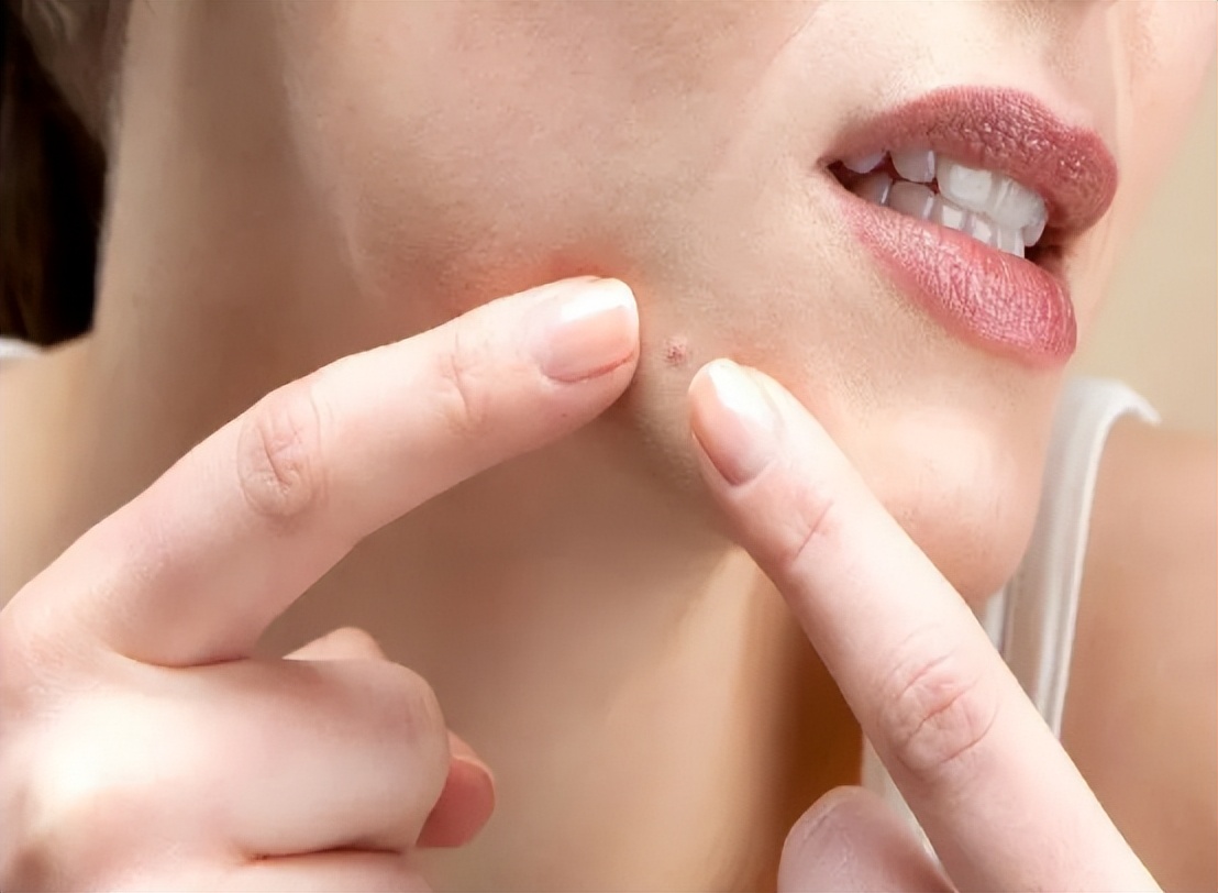 男性雄性激素越旺盛越好吗,男人50岁后雄性激素旺会脱发吗