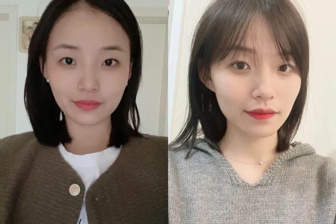 发量少的人建议剪短发吗,为啥医生建议剪短发