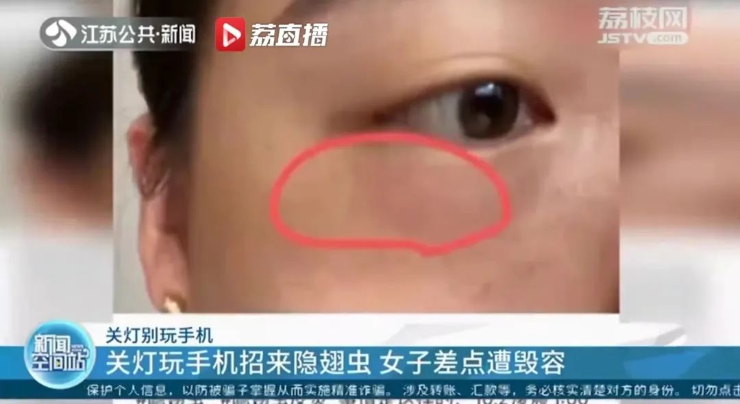 夏季常见蚊虫叮咬图鉴,女孩被家人吸血10年