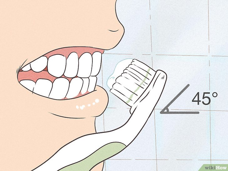 牙菌斑清除动画,清除深处的牙菌斑