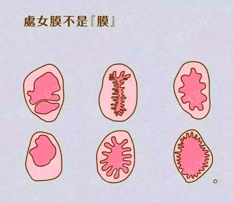 医生总结：最伤害“阴道”的几大行为，你是否还在经常做？