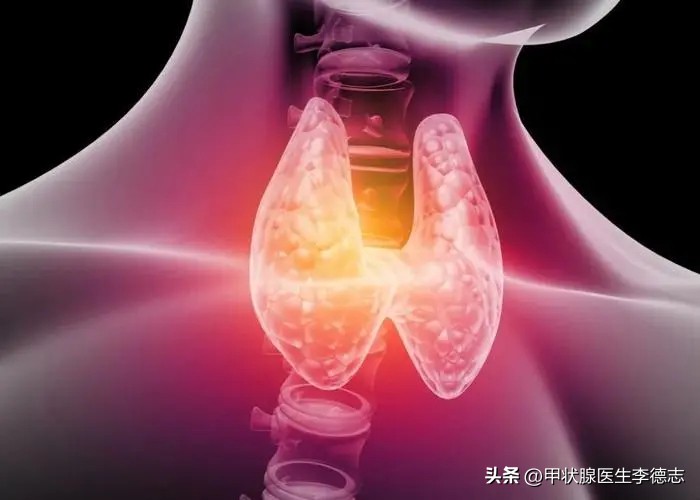 甲状腺知识课堂电话,甲状腺肿大最好的治疗方法有哪些