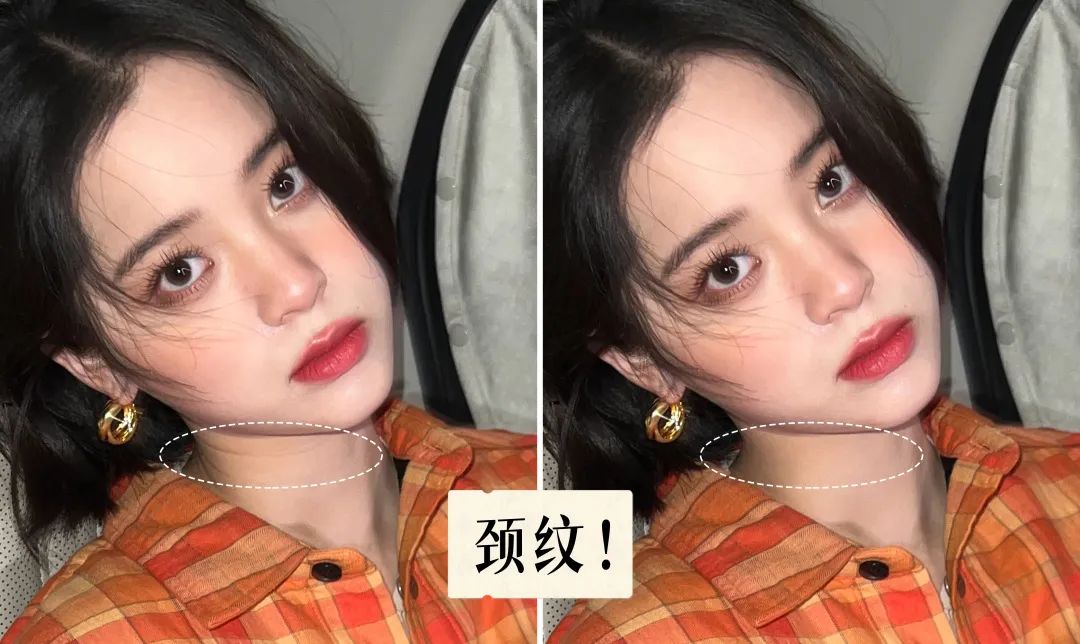 1条颈纹=显老10岁，可怕的颈纹还有救吗？