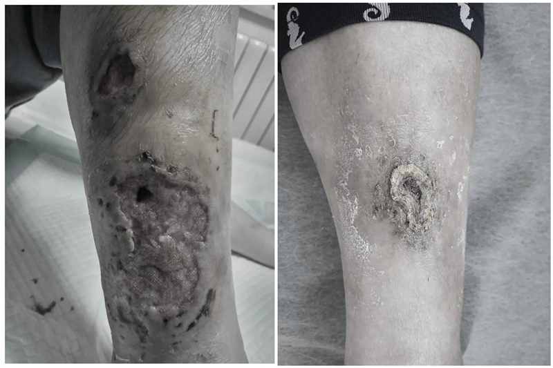 郑女士得抑郁症,郑女士去医院治疗