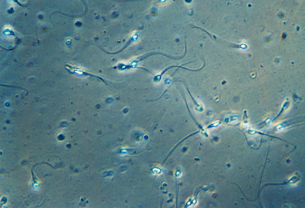 避孕套前面的尖尖有何用？关于避孕套的这些知识，男女都建议了解