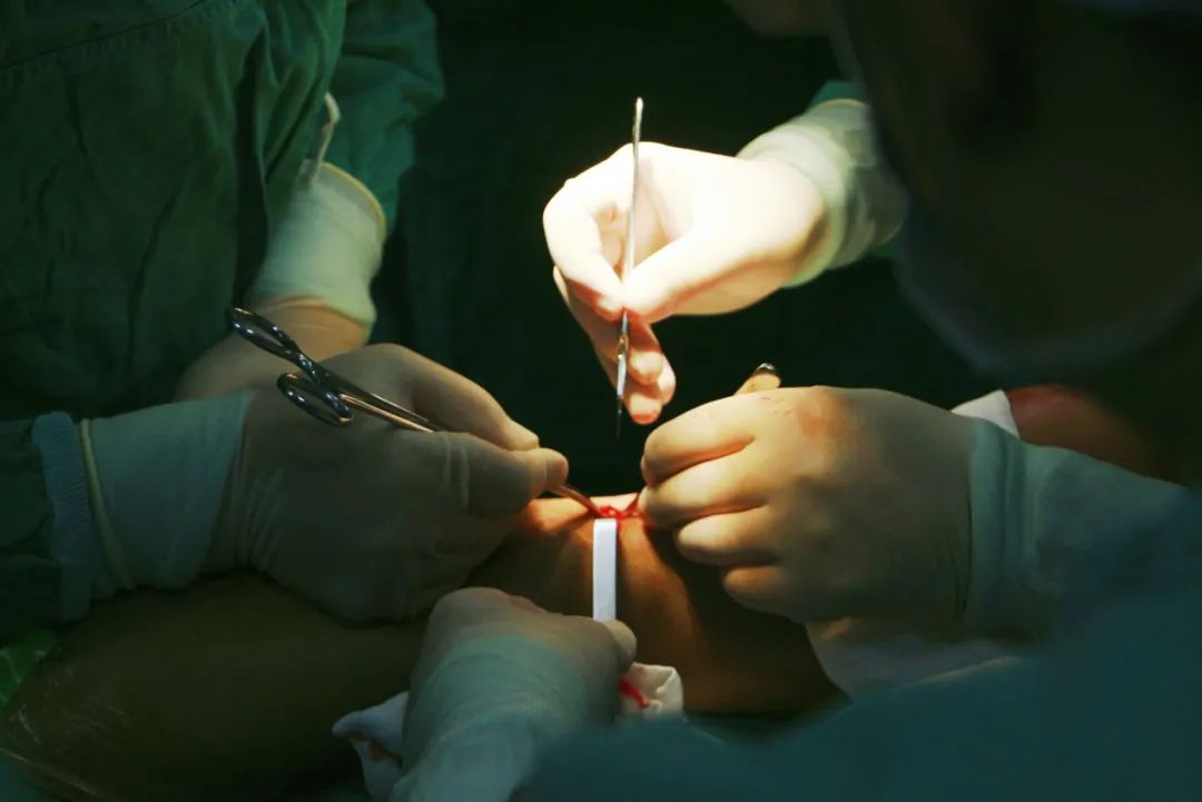 哈达迪姚明亚洲第一中锋,哈达迪跟腱断裂