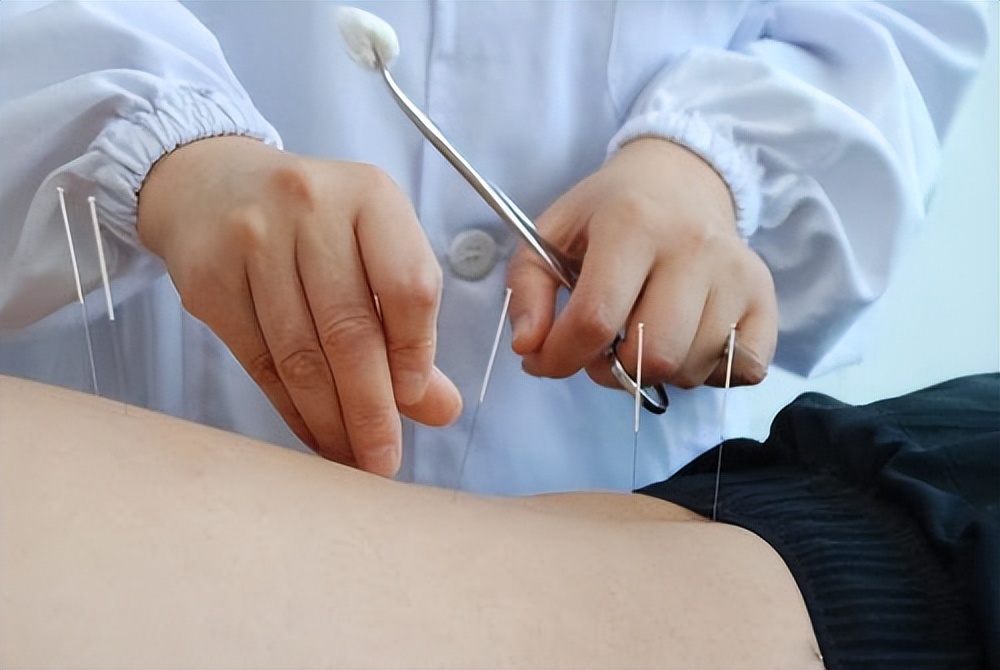 治腰椎间盘突出埋线得几天见效,腰椎间盘突出电针灸治疗的原理