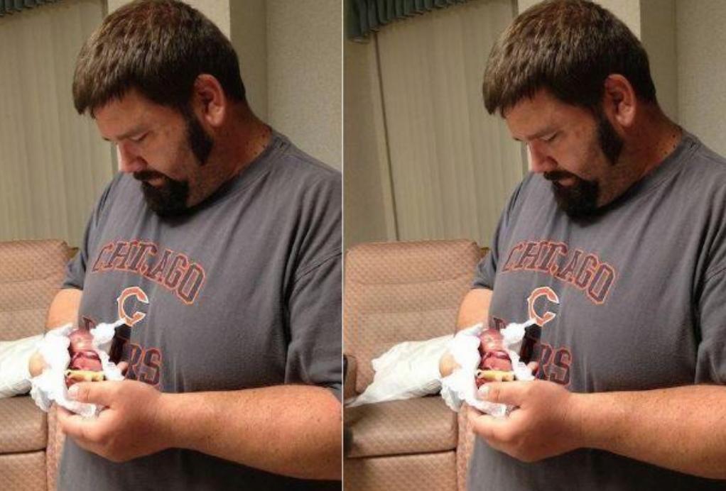 拇指姑娘出生时只有10公分,拇指姑娘出生时仅280克长大