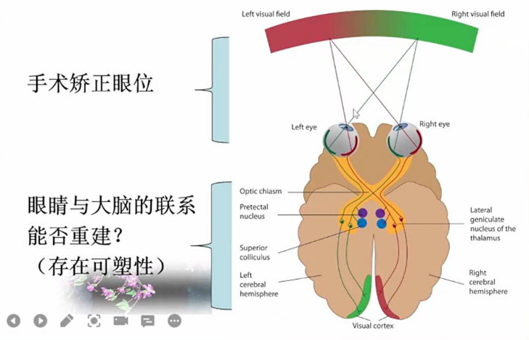 中山眼科陈静嫦做斜视手术吗,中山眼科陈静嫦做斜视手术好吗
