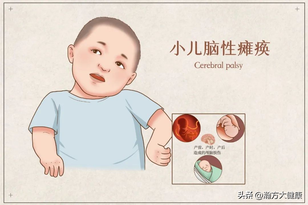 宝宝抽搐翻白眼和惊吓有关吗,一周宝宝突然抽搐翻白眼什么原因