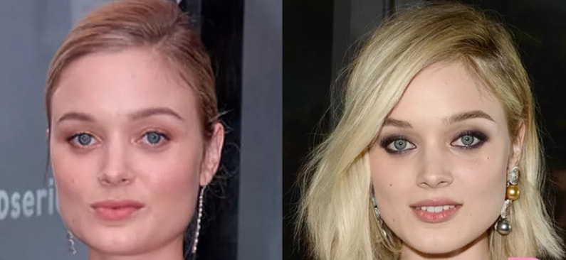 方脸的优势是什么,方脸真的可以逆袭吗