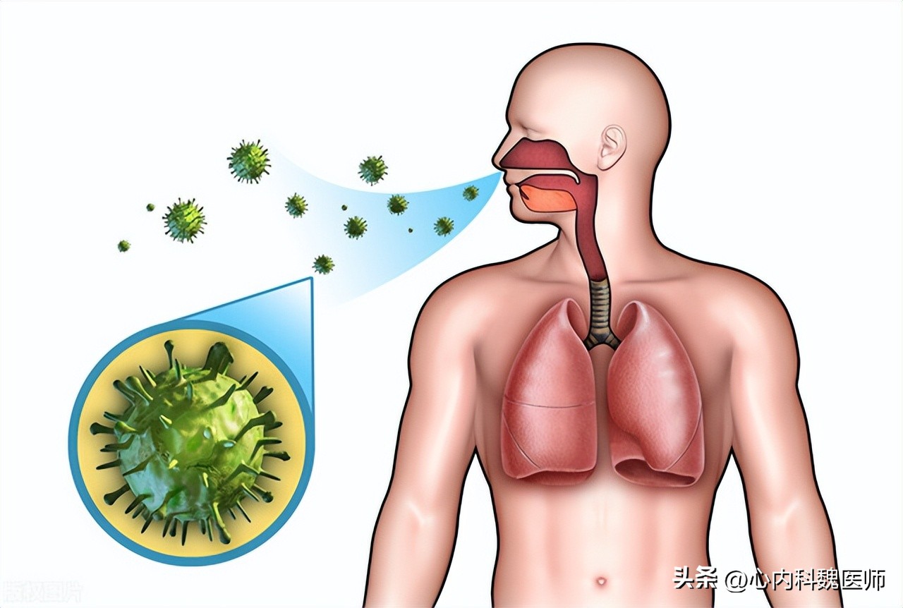 盐酸氨溴索口服溶液治疗肺炎,盐酸氨溴索片对支原体肺炎有效吗