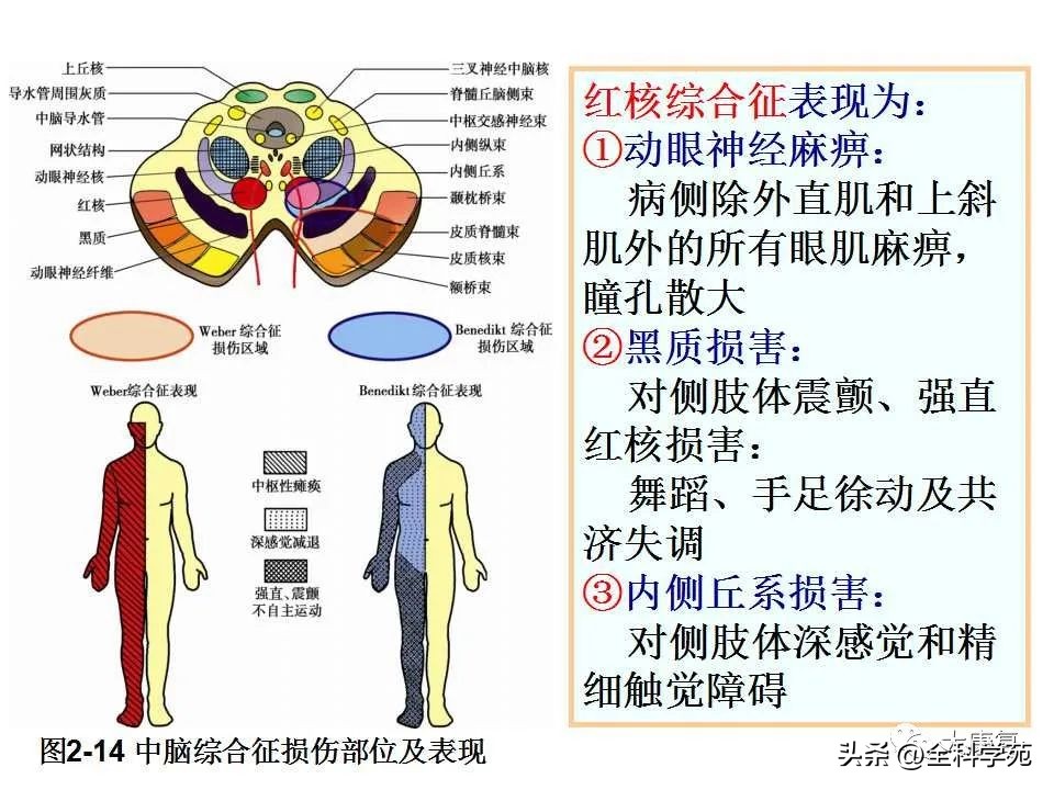 神经系统的影像与解剖定位,最全神经解剖图