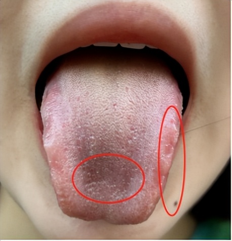 大姨妈提前来是什么原因,大姨妈老是下午来正常吗