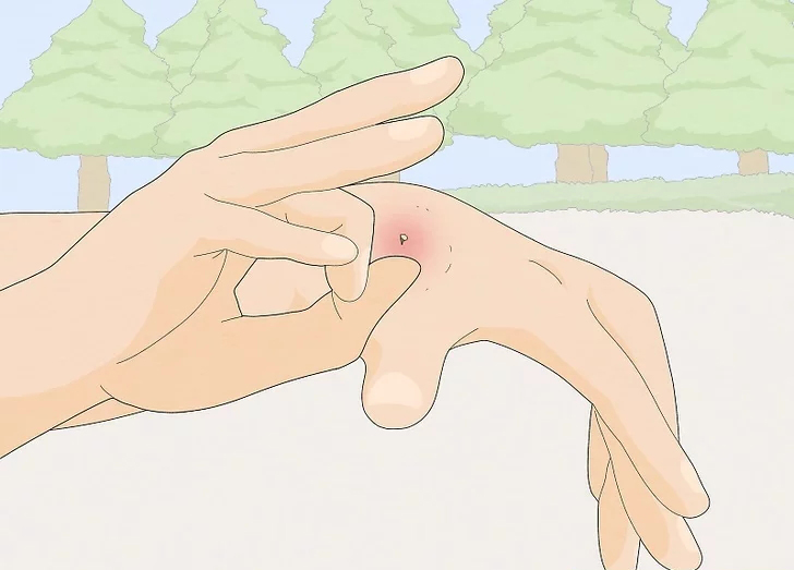 被10000只蜜蜂蛰会怎么样,如果蜜蜂蜇我们蜜蜂会死吗