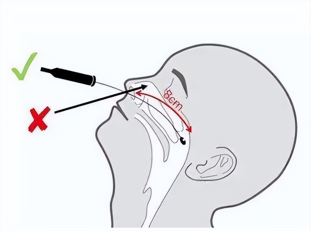 戳舌头、刮牙齿、捅喉咙，哪个才是正确的核酸采样方法？不小心碰到核酸管里的红色液体，有影响吗？