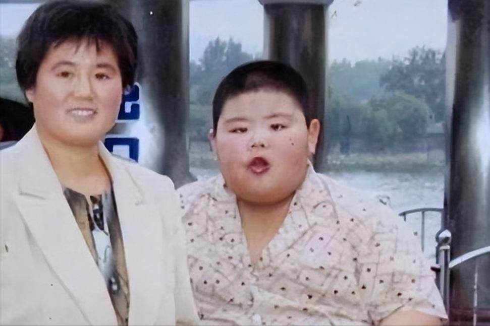 减肥400斤王浩楠照片,山东减肥小伙王浩楠现状