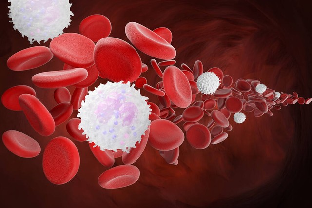 白细胞增多是白血病还是感染,白细胞明显增多是白血病吗