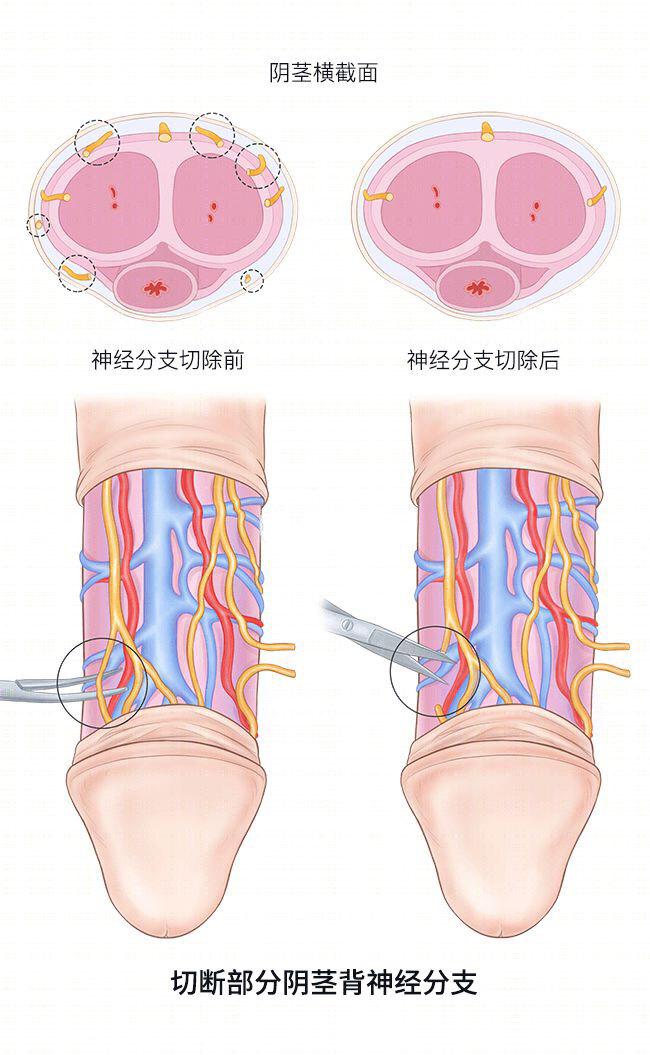 快枪手深度解析,快枪手翻盘