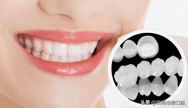 牙齿那些事,有关牙齿那些事儿