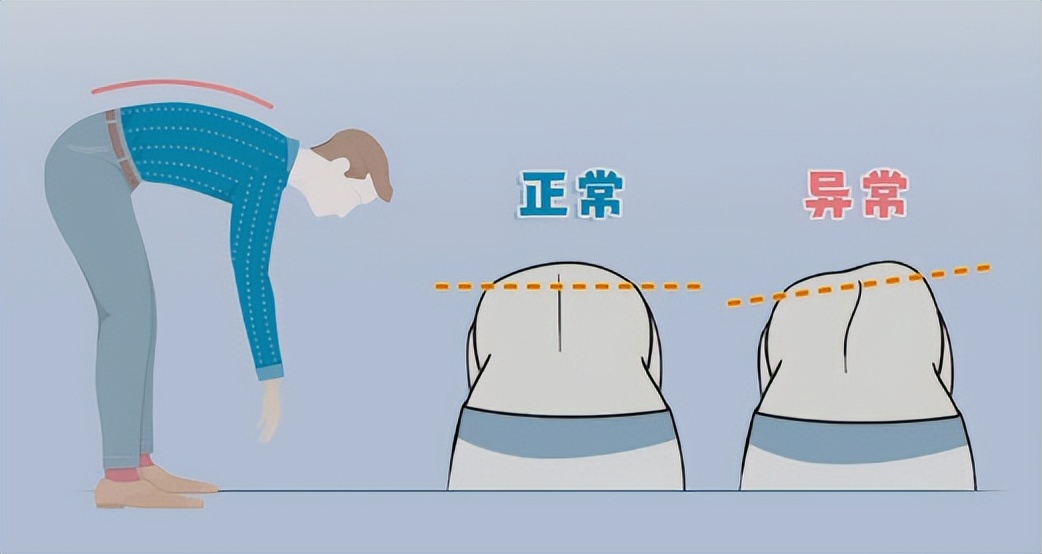 孩子站立老是歪向一边,小孩子坐姿不矫正怎么改正