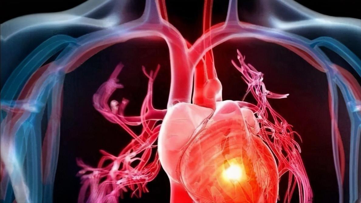 心脏瓣膜病手术具体怎么做,心脏瓣膜病什么程度需要手术