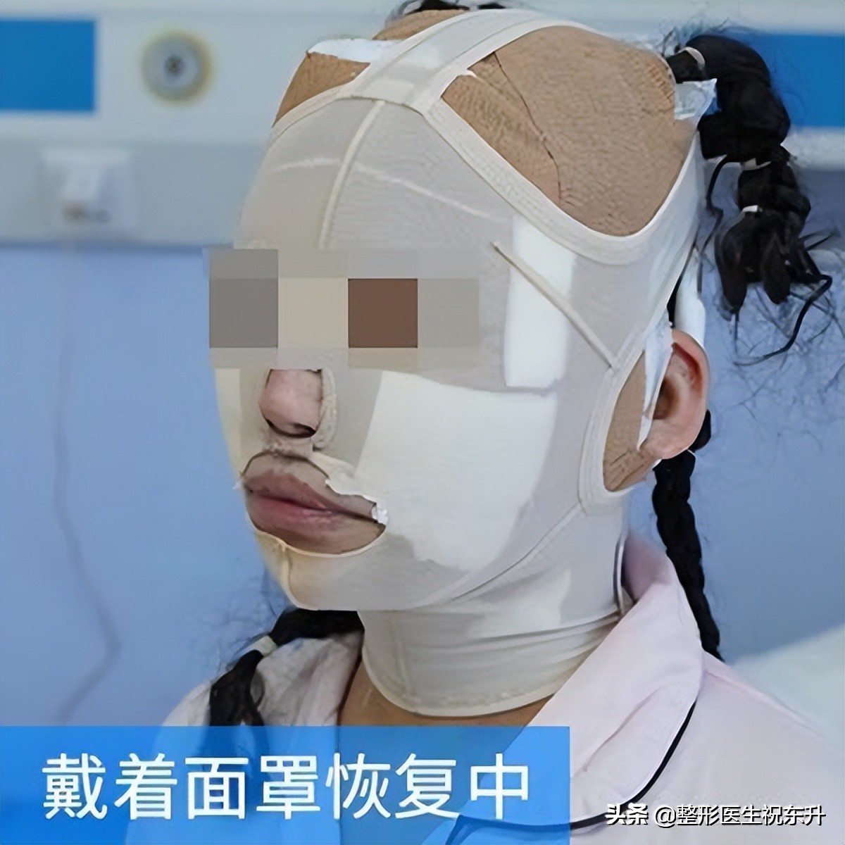 拉皮手术面诊,华西拉皮手术面诊后多长时间手术